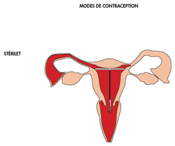 Contraception - Réseau MYPA